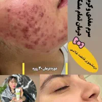 مشاور نمایندگی محصولات لاکچری کوین،ویتابلا|آرایشی، بهداشتی، درمانی|الیگودرز, |دیوار