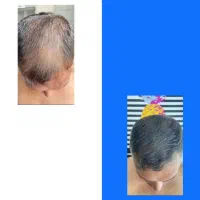 موهات یه شانس دیگه میخواد