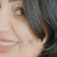 چال گونه تخصصی و پیرسینگ برای بانوان عزیز