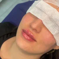 قیمتهای استثنایی کلینیک زیبایی تزریق فیلر ،بوتاکس|خدمات آرایشگری و زیبایی|نسیمشهر, |دیوار