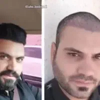 کاشت موکاشت ابرو+ اموزش کاشت مو نقد، اقساط تضمینی|خدمات آرایشگری و زیبایی|شیراز, عفیف‌آباد|دیوار