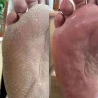 تخفیف ویژه پدیکور پا|خدمات آرایشگری و زیبایی|تبریز, |دیوار