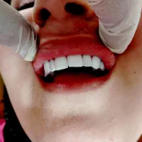 آموزش دندانپزشکی و دندان سازی و کامپوزیت و لمینت