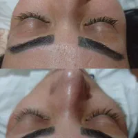 فشیال پاکسازی پوست