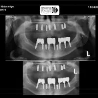 مرکز تخصصی ایمپلنت دیجیتال..|خدمات آرایشگری و زیبایی|تهران, زعفرانیه|دیوار