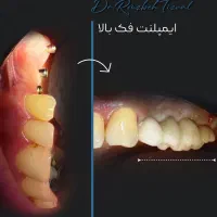 ادمین اینستاگرام هستم زیبایی دندانپزشکی و...