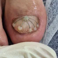 دکتر پا ،درمانگر ناخن و پوست پا
