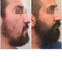 رشد مو VIP|آرایشی، بهداشتی، درمانی|تهران, طرشت|دیوار