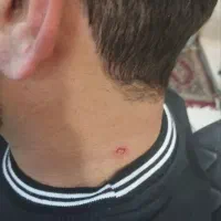 اصلاح خالبرداری لیزری پرسینگ گوش پاکسازی کامل پوست|خدمات آرایشگری و زیبایی|محمودآباد, |دیوار