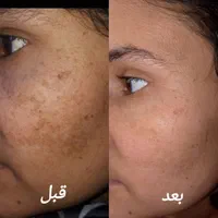 فشیال پاکسازی آموزش تخصصی درمانی همراه مدرک|خدمات آموزشی|تهران, سلسبیل جنوبی|دیوار