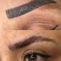 کلینیک تخصصی ریموو تتو