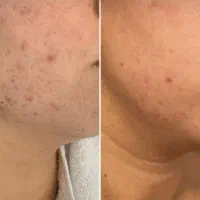 اموزش ویژه پوست ومو