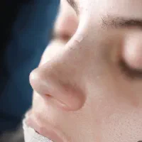 تخفیف ویژه رینوپلاسی عمل بینی تزریق چربی جراحی پلک