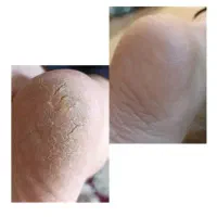 کاشت و ترمیم ،اسپا و پدیکور پا