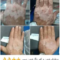 علاقمندان  به درمان با دارو گیاهی  پیام بذارند|استخدام درمانی، زیبایی، بهداشتی|مسجد سلیمان, |دیوار