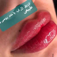 آموزش خدمات زیبایی  تزریق ژل .فیلر .بوتاکس .چربی|خدمات آموزشی|رشت, گلسار|دیوار