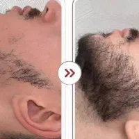 درش بیار ریشاتو میگم