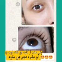 سرم تقویت مژه وابرو(تضمینی)