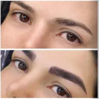 اجاره اتاق ۳۰متری مناسب فشیال وپاک سازی پوست