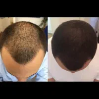 اسکالپ سر|خدمات آرایشگری و زیبایی|گرگان, |دیوار