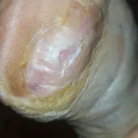 کارشناس زخم پانسمان نوین درمان در منزل|خدمات آرایشگری و زیبایی|ری, اقدسیه|دیوار