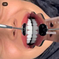 خدمات دندانپزشکی (بانرخ تامین اجتماعی )|خدمات آرایشگری و زیبایی|تبریز, |دیوار