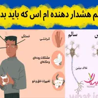 کنترل ام اس با تشخیص به موقع ودرمان