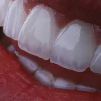 جشنواره لبخند با شرایط باور نکردنی