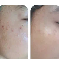 پاکسازی صورت