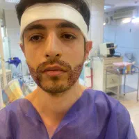 کاشت مو، ریش و ابرو با جدیدترین متد روز دنیا|خدمات آرایشگری و زیبایی|شیراز, عفیف‌آباد|دیوار