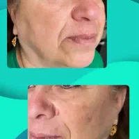 نمایندگی ببرراضی نبودی پولتوپس بگیربدون لایه بردار