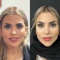 جوانسازی صورت