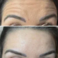 مدل ژل پیرسینگ مژه چال میکرو بوتاکس چشم گربه ای|خدمات آرایشگری و زیبایی|قم, نیروگاه|دیوار