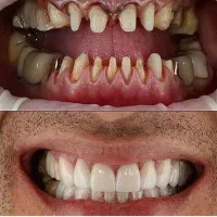 خدمات دندان پزشکی لبخند سفید