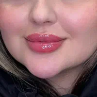 آفر ویژه تزریقات ژل و بوتاکس در کلینیک فقط ۶۸۰|خدمات آرایشگری و زیبایی|نجف‌آباد, حومه نجف آباد|دیوار