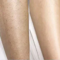 لیزر سوپراتیتانیوم ۲۰۲۶ دارای ۴ طول موج و کولینگ
