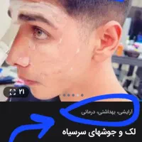 اکتیواتوفن پوست|آرایشی، بهداشتی، درمانی|سنندج, |دیوار