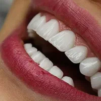 سلامت دندان مهمترین عنصر آراستگی صورت|خدمات آرایشگری و زیبایی|کرمان, |دیوار