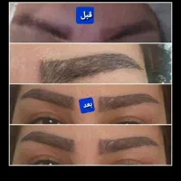 جشنواره کاشت مو و ابرو در تهران و کرج|خدمات آرایشگری و زیبایی|تهران, صاحبقرانیه|دیوار