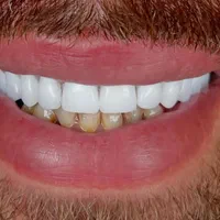 دندان مصنوعی تخصص ماست..|خدمات آرایشگری و زیبایی|پردیس, فاز ۸|دیوار