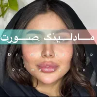 کلینیک تخصصی تزریق فیلر/ژل لب روسی/مادلینگ نچرال|خدمات آرایشگری و زیبایی|تهران, الهیه|دیوار