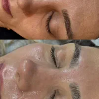 فیشال تخصصی ودرمانی.احیاوکراتین مو
