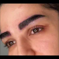 کاشت مو وابروی تخصصی با تکنیک نانوسل|خدمات زیبایی و سلامت|تهران, نیلوفر|دیوار