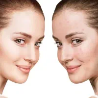 فیشیال تخصصی