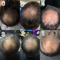 تزریق و آموزش ژل و بوتاکس|خدمات آرایشگری و زیبایی|تهران, مسعودیه|دیوار