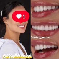 دندانپزشکی دنتال ونیر کامپوزیت لمینت ایمپلنت|خدمات آرایشگری و زیبایی|تهران, تجریش|دیوار