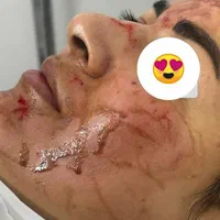 اولین درمانگرلک با متدپکینگ آپ وحذف تک جلسه کک مک|خدمات آرایشگری و زیبایی|بوشهر, |دیوار