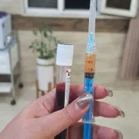 تزریق ژل و بوتاکس