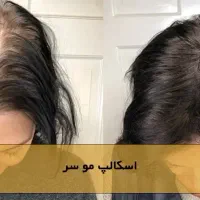 انجام خدمات تتو صورت و بدن بانوان ،اسکالپ کف سر|خدمات آرایشگری و زیبایی|فولادشهر, A2|دیوار