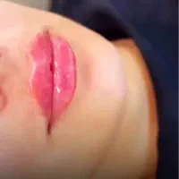 جشنواره فول فیس توسط پزشک متخصص|خدمات آرایشگری و زیبایی|تهران, ونک|دیوار